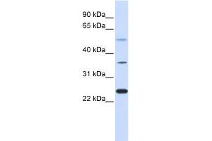 WB Suggested Anti-ZNF488 Antibody Titration:  0. (ZNF488 抗体  (Middle Region))
