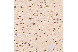 Immunohistochemistry of paraffin embedded mouse brain using ALS2CR13 (ABIN7073909) at dilution of 1:1800 (400x lens) (FAM117B 抗体)