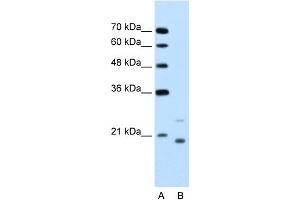 WB Suggested Anti-UBE2D1 Antibody Titration:  1.
