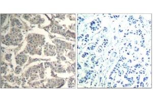 Image no. 3 for anti-Cofilin 1 (CFL1) (Tyr88) antibody (ABIN319381) (Cofilin 抗体  (Tyr88))
