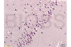 Formalin-fixed and paraffin embedded: rat brain tissue labeled with Anti-bFGF Polyclonal Antibody, Unconjugated (ABIN726425) at 1:200, followed by conjugation to the secondary antibody and DAB staining (FGF2 抗体  (AA 143-250))