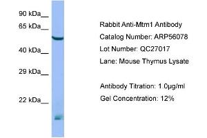 Western Blotting (WB) image for anti-Myotubularin 1 (MTM1) (N-Term) antibody (ABIN2786502) (MTM1 抗体  (N-Term))