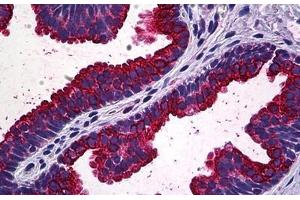 Human Prostate: Formalin-Fixed, Paraffin-Embedded (FFPE) (MAPK13 抗体  (AA 251-365))