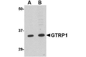 Western blot analysis of GRTP1 in K562 cell lysate with AP30387PU-N GRTP1 antibody at (A) 1 and (B) 2 μg/ml. (GRTP1 抗体  (N-Term))