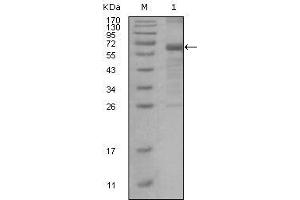 Western blot analysis using MSH6 mouse mAb against truncated MSH6 recombinant protein. (MSH6 抗体)