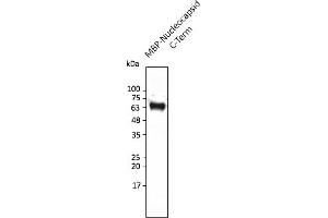 Western Blotting (WB) image for anti-SARS-CoV-2 Nucleocapsid (SARS-CoV-2 N) (C-Term) antibody (ABIN7272991) (SARS-CoV-2 Nucleocapsid 抗体  (C-Term))