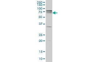 ZNF181 monoclonal antibody (M01), clone 5F1 Western Blot analysis of ZNF181 expression in A-431 . (ZNF181 抗体  (AA 354-461))
