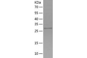 SGF29 Protein (AA 1-293) (His tag)