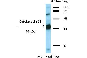 Western blotting analysis of human cytokeratin 19 using mouse monoclonal antibody BA-17 on lysates of HT-29 cell line and MOLT-4 cell line (cytokeratin non-expressing cell line, negative control) under non-reducing and reducing conditions. (Cytokeratin 19 抗体  (Biotin))