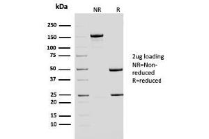 SDS-PAGE Analysis Purified ERCC1 Mouse Monoclonal Antibody (ERCC1/2683). (ERCC1 抗体  (AA 191-281))