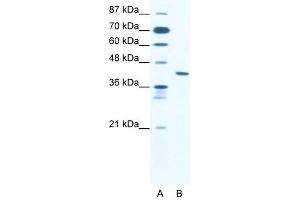 ZNF621 antibody (20R-1078) used at 0. (ZNF621 抗体  (Middle Region))
