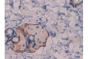 DAB staining on IHC-P; Samples: Rat Skin Tissue (Reelin 抗体  (AA 2400-2610))