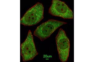 Immunofluorescence (IF) image for anti-Methionine Sulfoxide Reductase A (MSRA) antibody (ABIN3003138) (MSRA 抗体)