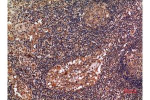 Immunohistochemistry (IHC) image for anti-Aldehyde Dehydrogenase 2 Family (Mitochondrial) (ALDH2) (N-Term) antibody (ABIN3187866)