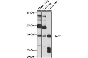 Western blot analysis of extracts of various cell lines, using R Polyclonal Antibody (ABIN3021523, ABIN3021524, ABIN3021525 and ABIN6215193) at 1:1000 dilution.