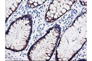 Immunohistochemical staining of paraffin-embedded Human colon tissue using anti-LXN mouse monoclonal antibody. (Latexin 抗体)