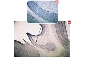 Expression of TRPC3 in mouse cerebellumImmunohistochemical staining of mouse cerebellum using Anti-TRPC3 Antibody (ABIN7043820, ABIN7043966 and ABIN7043967) (A).