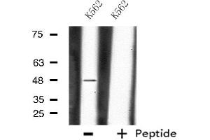 Western blot analysis of extracts from K562 cells, using CHST1 antibody. (CHST1 抗体  (Internal Region))