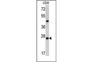 Image no. 1 for anti-Dicer 1, Ribonuclease Type III (DICER1) (AA 1010-1040), (Middle Region) antibody (ABIN357311) (DICER1 抗体  (Middle Region))