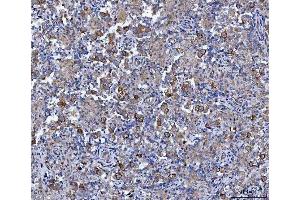 IHC analysis of CCNB1 using anti-CCNB1 antibody (ABIN7599335).