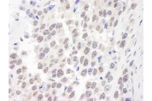 Immunohistochemistry (IHC) image for anti-Werner syndrome RecQ like helicase (WRN) (C-Term) antibody (ABIN7448866)