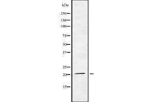 Western blot analysis of MED29 using HT29 whole cell lysates (MED29 抗体  (Internal Region))