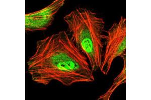 Immunocytochemistry (ICC) image for anti-CCAAT/enhancer Binding Protein (C/EBP), alpha (CEBPA) antibody (ABIN1845802) (CEBPA 抗体)