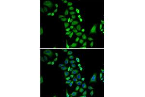 Immunofluorescence analysis of A-549 cells using GLO1 antibody (ABIN3015726, ABIN3015727, ABIN3015728 and ABIN6219077). (GLO1 抗体  (AA 1-184))