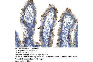 Rabbit Anti-EXOSC3 Antibody  Paraffin Embedded Tissue: Human Intestine Cellular Data: Epithelial cells of intestinal villas Antibody Concentration: 4. (EXOSC3 抗体  (Middle Region))