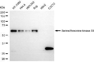 Western blotting analysis using serine/threonine kinase 33 antibody (ABIN7800313). (Recombinant STK33 抗体)