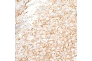 Immunohistochemistry (IHC) image for anti-Y Box Binding Protein 1 (YBX1) (AA 224-274) antibody (ABIN7453588) (YBX1 抗体  (AA 224-274))