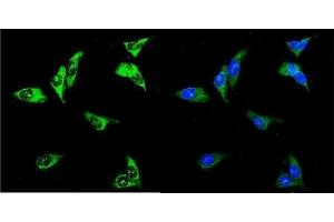 IF analysis of UPF3A using anti-UPF3A antibody (ABIN7601625). (UPF3A 抗体  (AA 4-452))