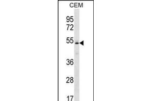 KCNJ4 Antibody (N-term) (ABIN656232 and ABIN2845547) western blot analysis in CEM cell line lysates (35 μg/lane). (KCNJ4 抗体  (N-Term))