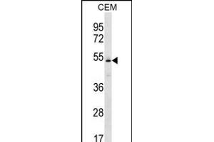 Western Blotting (WB) image for anti-Potassium Inwardly-Rectifying Channel, Subfamily J, Member 4 (KCNJ4) (AA 1-30), (N-Term) antibody (ABIN656232)