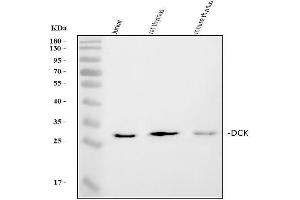 Western blot analysis of DCK using anti-DCK antibody (ABIN5693016).