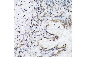 Immunohistochemistry of paraffin-embedded rat lung using Histone H1t Rabbit pAb (ABIN7267716) at dilution of 1:100 (40x lens). (Histone H1 抗体  (AA 150-207))