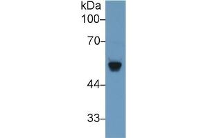 Western Blotting (WB) image for anti-beta-Site APP-Cleaving Enzyme 2 (BACE2) (AA 242-502) antibody (ABIN7438730)
