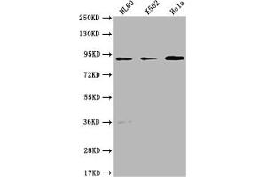 Western Blot Positive WB detected in: HL60 whole cell lysate, K562 whole cell lysate, Hela whole cell lysate All lanes: RPTN antibody at 1:1000 Secondary Goat polyclonal to rabbit IgG at 1/50000 dilution Predicted band size: 91 kDa Observed band size: 91 kDa (Repetin 抗体  (AA 86-103))