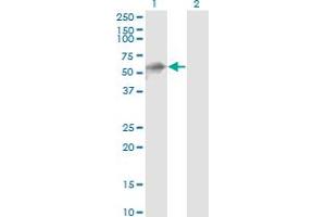Western Blot analysis of KBTBD10 expression in transfected 293T cell line by KBTBD10 monoclonal antibody (M01), clone 1H3. (Kelch-like protein 41 (KLHL41) (AA 205-304) 抗体)