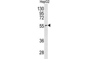 Western Blotting (WB) image for anti-Nucleoporin 62kDa (NUP62) antibody (ABIN3003247) (NUP62 抗体)