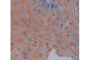 IHC-P analysis of Human Tissue, with DAB staining. (TRAF6 抗体  (AA 153-423))