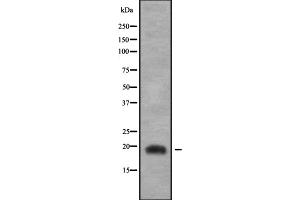 Western blot analysis of JDP2 using COLO205 whole cell lysates (JDP2 抗体  (C-Term))