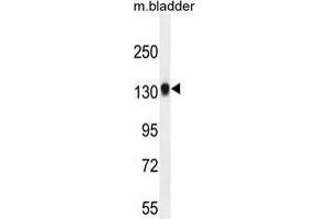 TDRD7 Antibody (C-term) western blot analysis in mouse bladder tissue lysates (35 µg/lane). (TDRD7 抗体  (C-Term))
