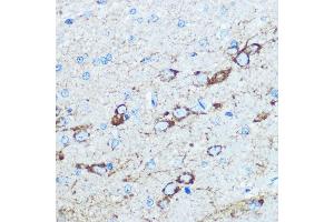 Immunohistochemistry of paraffin-embedded rat brain using NMD Rabbit pAb (ABIN6133733, ABIN6141400, ABIN6141403 and ABIN6223602) at dilution of 100 (40x lens). (GRIN1/NMDAR1 抗体  (AA 600-700))