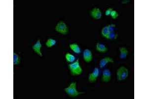 Immunofluorescent analysis of MCF-7 cells using ABIN7170144 at dilution of 1:100 and Alexa Fluor 488-congugated AffiniPure Goat Anti-Rabbit IgG(H+L) (SLC22A2 抗体  (AA 48-135))