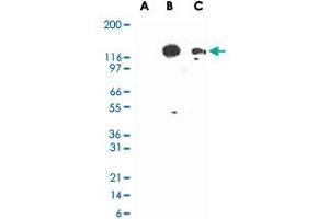 Western blot analysis of TLR3 in lysates from untransfected 293 cells (lane A), 293 cells transfected with human TLR3 cDNA (lane B), and 20 ug/lane human intestine tissue lysate (lane C). (TLR3 抗体)
