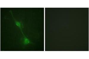 Immunofluorescence analysis of NIH-3T3 cells, using Ataxin 1 (Ab-776) Antibody. (Ataxin 1 抗体  (AA 742-791))