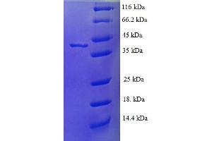 FTSJ1 Protein (AA 1-329, full length) (His tag)
