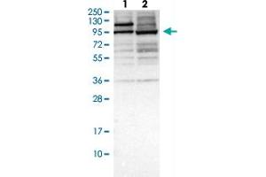Western blot analysis of Lane 1: Human cell line RT-4 Lane 2: Human cell line U-251MG sp with ZKSCAN5 polyclonal antibody .