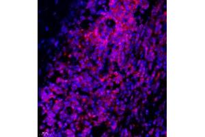 Immunofluorescence of paraffin embedded human lymph node using Thymosin (ABIN7075306) at dilution of 1:1500 (400x lens) (PTMA 抗体)